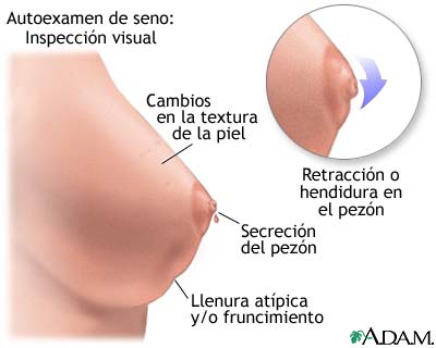 AUTOEXAMEN DE SENO